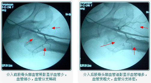 血管增多.jpg