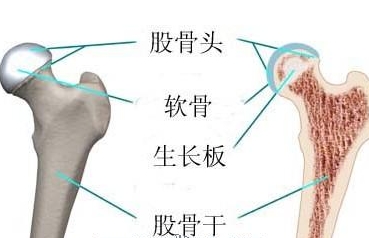 股骨头坏死